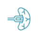 Robotic Gallbladder Surgery